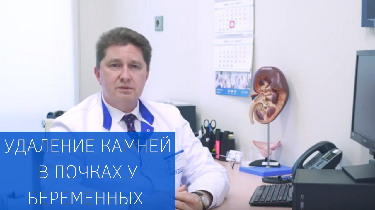 Безопасное удаление камней в почках у беременных