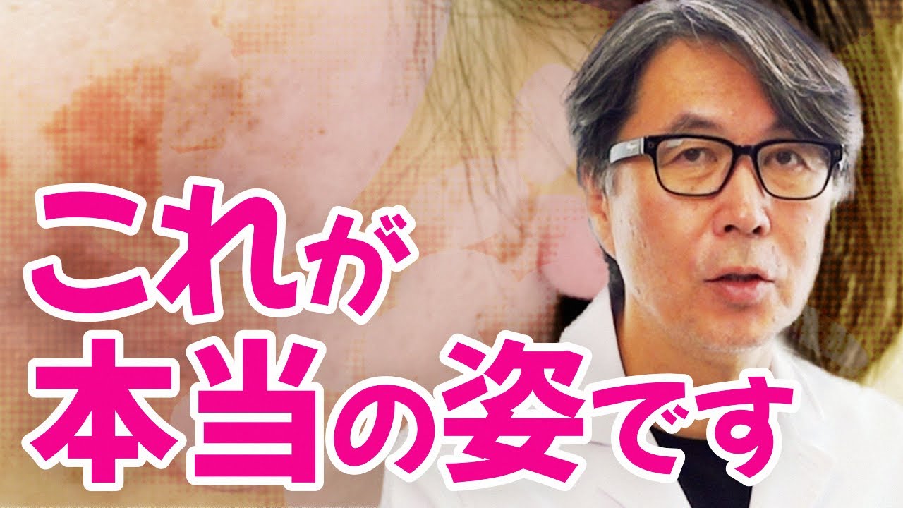 知らないと損する、トラネキサム酸の実態