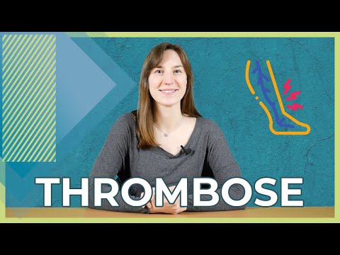 Thrombose 2021 | Kurz Erklärt | Symptome Und Behandlungsmöglichkeiten