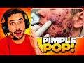 Reacting to Extreme CYST & Pimple Popping Videos (SO SATISFYING)