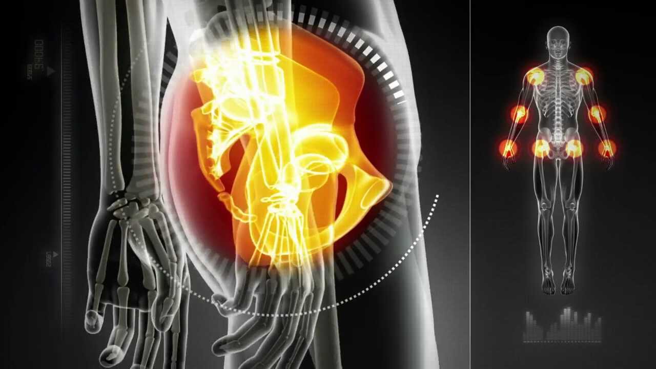 The Gait Guys talk about Foot Strike problems in runners.