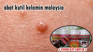 obat kutil kelamin malaysia