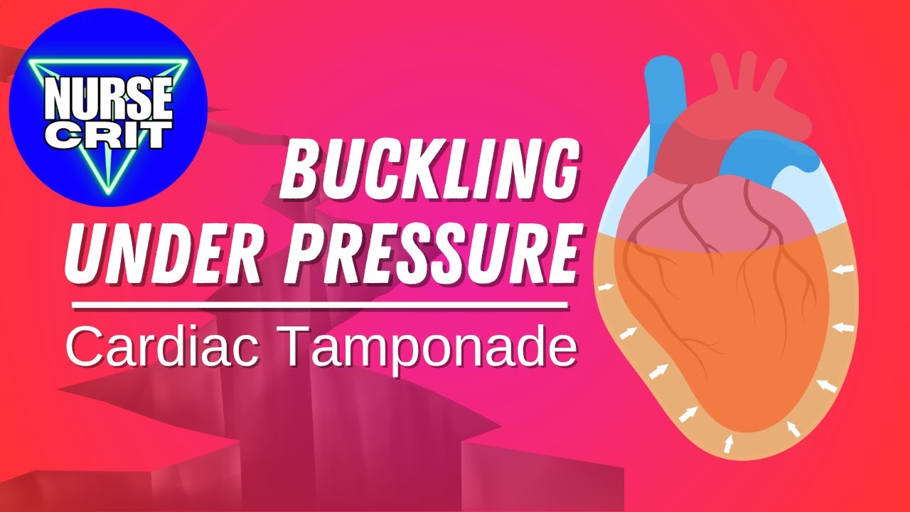 Cardiac Tamponade: Identifying This Lethal Condition