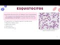 "Cuando no hay tiempo que perder" El rol del laboratorio en la urgencia hematologica