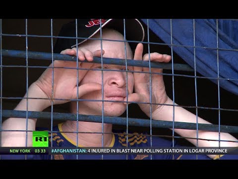 Video: In Welke Landen Lopen Albino's Risico?