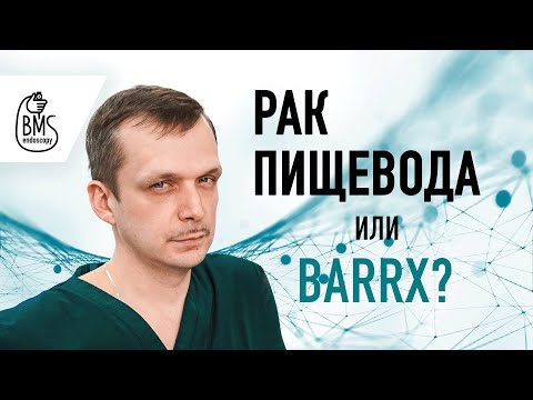 Рак пищевода или Barrx? Пищевод Барретта: представление и возможности лечения #ракпищевода
