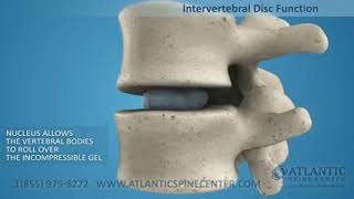 Tlif Transforaminal Lumbar Interbody Fusion