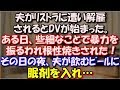 【修羅場】 夫がリストラに遭い解雇されるとモラハラが始まり、少しするとDVも始まった。ある日、些細なことで暴力を振るわれ根性焼きされた!その日の夜、夫が飲むビールに眠剤を入れ… スカッと修羅場ラバンダ