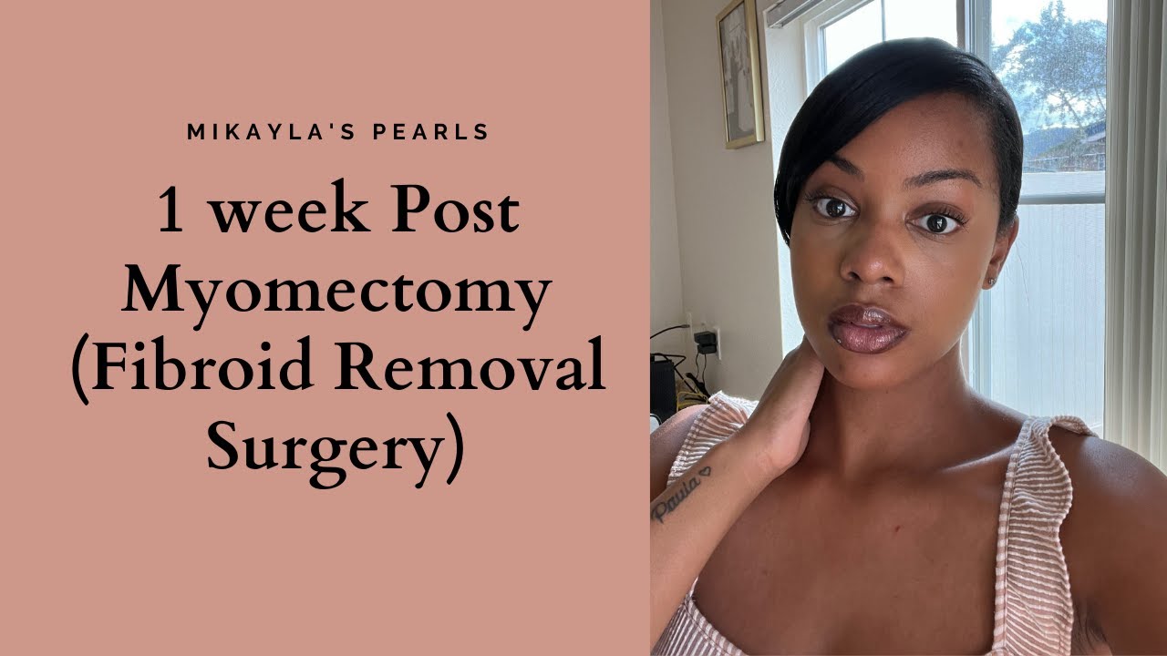 1 week Post Myomectomy (Fibroid Removal Surgery) YouTube