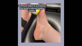SoftWave Tissue Regeneration Therapy at Alpharetta Family Chiropractic