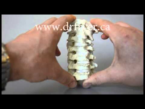 Cervical Instability Model by Dr. Jerome Fryer (Chiropractor)