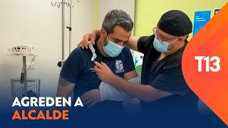 Alcalde de San Bernardo es agredido con piedras y golpes en fiscalización