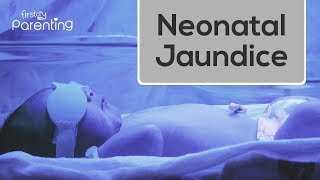 Neonatal Jaundice - Causes, Symptoms and Treatment screenshot 2