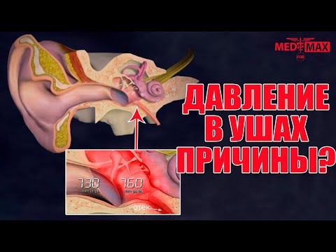 Давление в ушах: