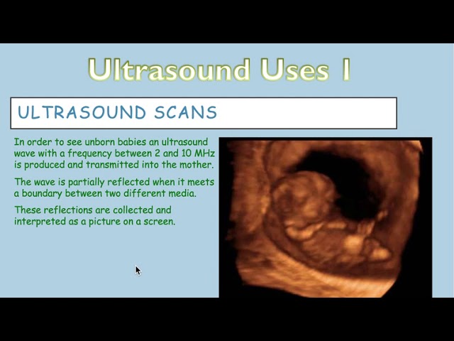 Ultrasound