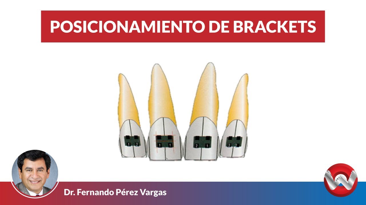Posicionamiento de Brackets YouTube