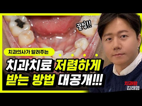   치과치료 저렴하게 받는 방법 꿀팁 대공개