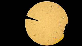 Unknown A Bacteria--Motility Test