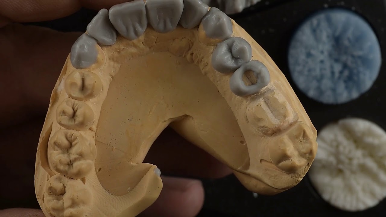 Wax up premolar  تشميع الضاحك الثاني العلوي
