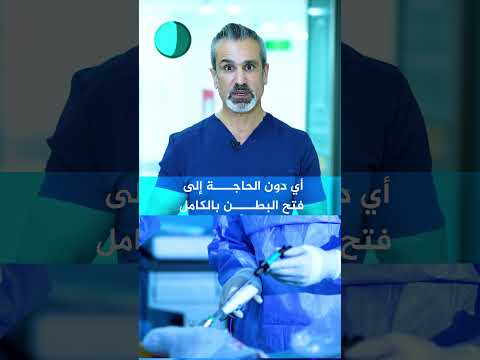 اكتشاف ورم سرطاني في القولون أثناء إجراء جراحة الزائدة الدودية
