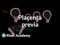 Understanding Placenta Previa