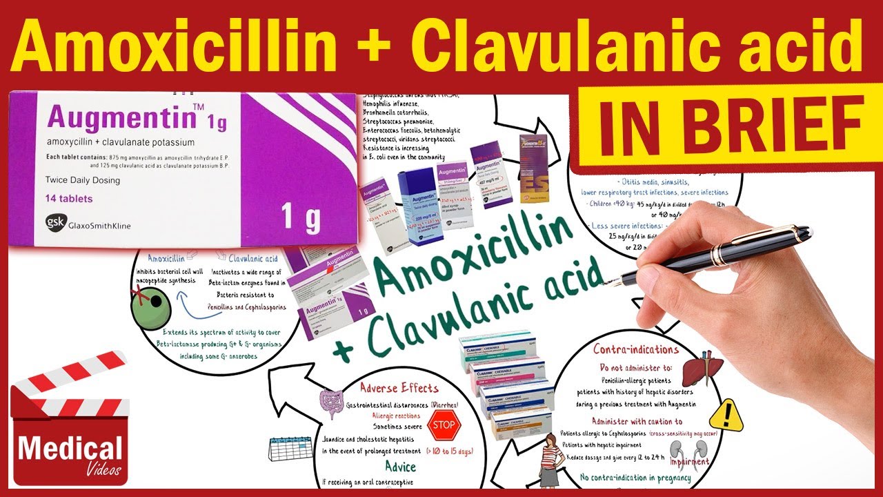 amoxicillin clavulanate prostate prostatita cu meloxicam