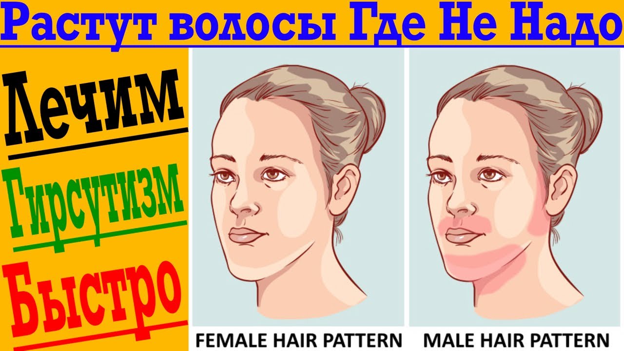 Волосы на груди не растут