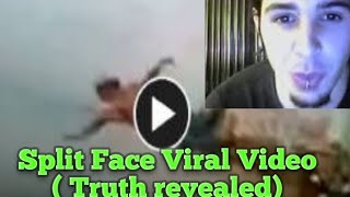 Split Face Diving Accident Diving Face Split Face Split Diving Accident Video Split Face Diving