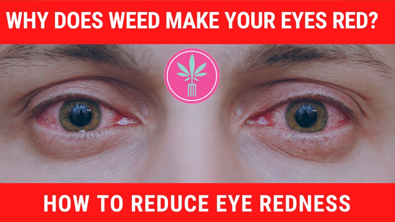 Why Does Weed Make Your Eyes Red? (And What You Can Do About It)