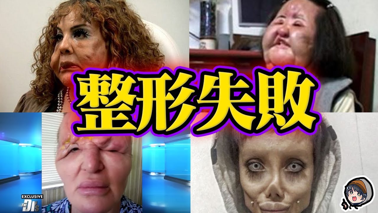 整形手術を失敗した人４選 闇 衝撃 Youtube