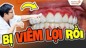 Bọc Răng Sứ Xong Bị Viêm Lợi: 2 Trường Hợp Này Sẽ Cần Tháo Ra Làm Lại