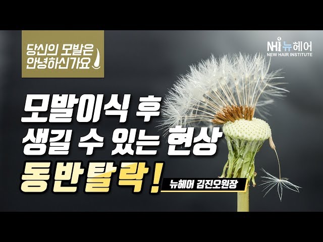 모발이식 후 생길수 있는 현상 동반탈락이란? (당신의 모발은 안녕하신가요?)