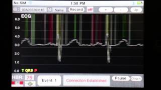 Smart 3-Lead ECG Node from EPFL-ESL