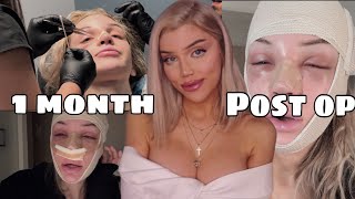 I was ugly so I got my WHOLE FACE done FFS UPDATE!!