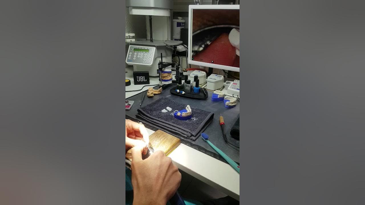 Dental die trimming with Renfert Easy View 3D YouTube