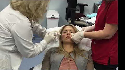 Vampire Face Lift Demo with Dr. Hudak