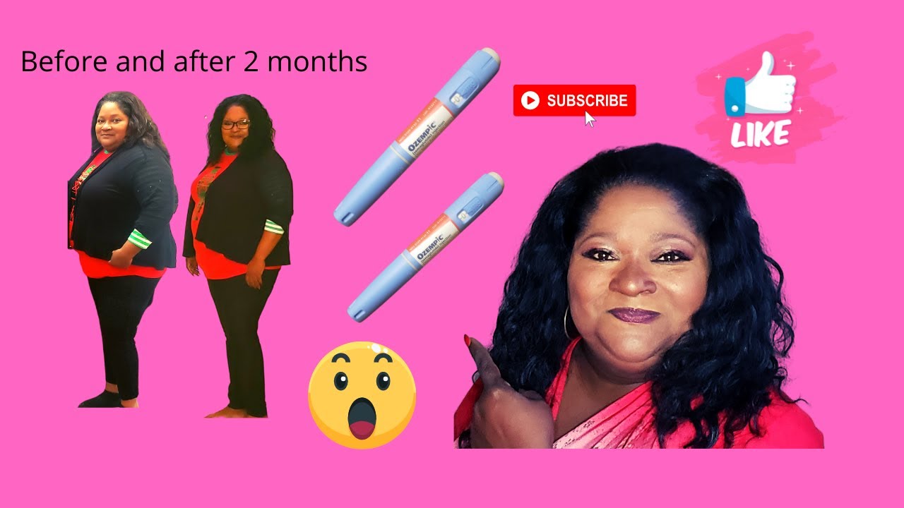Ozempic Weight Loss Before And After YouTube