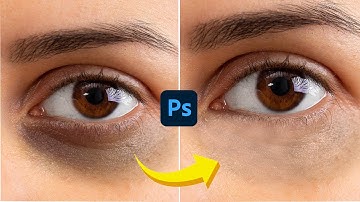 How To Remove Deep Dark Circle in Photoshop || Photoshop Tutorial