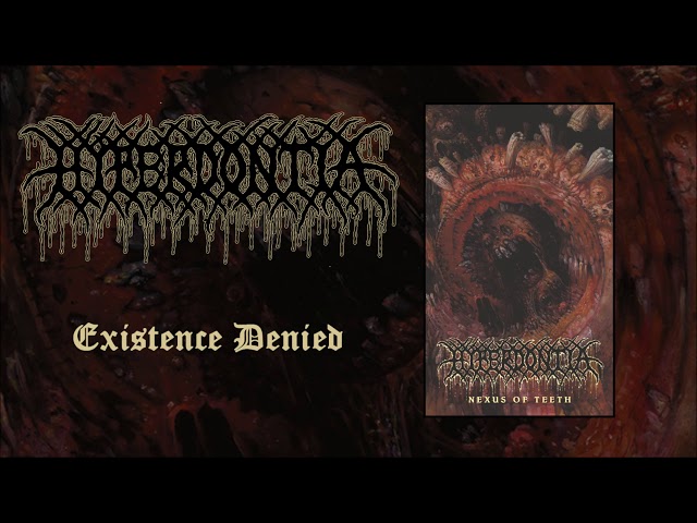 Hyperdontia - Existence Denied