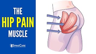 The Hip Pain Muscle How To Release It For Instant Relief