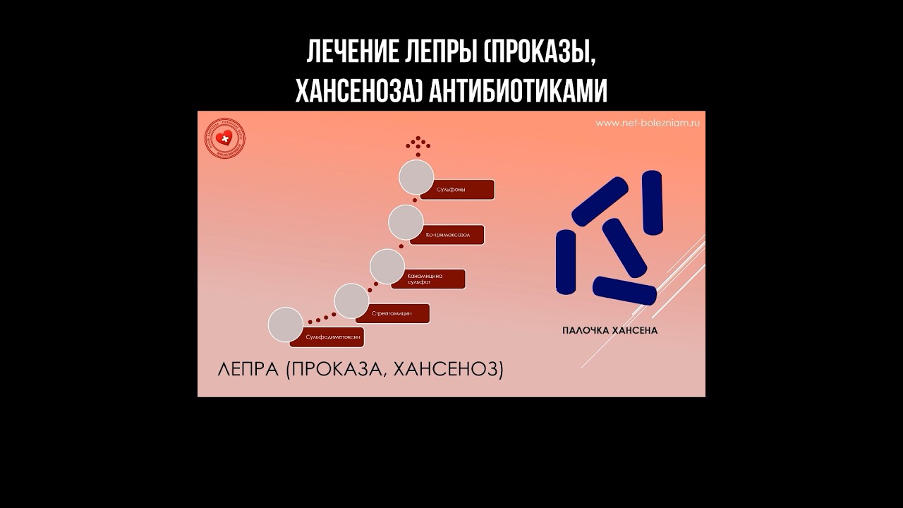 Лечение лепры (проказы, хансеноза) антибиотиками #лепра #проказа #хансеноз #антибиотики