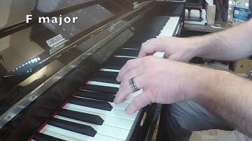 RCM Technique: Level 5 triads