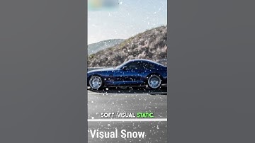 Visual Snow Syndrome Simulation