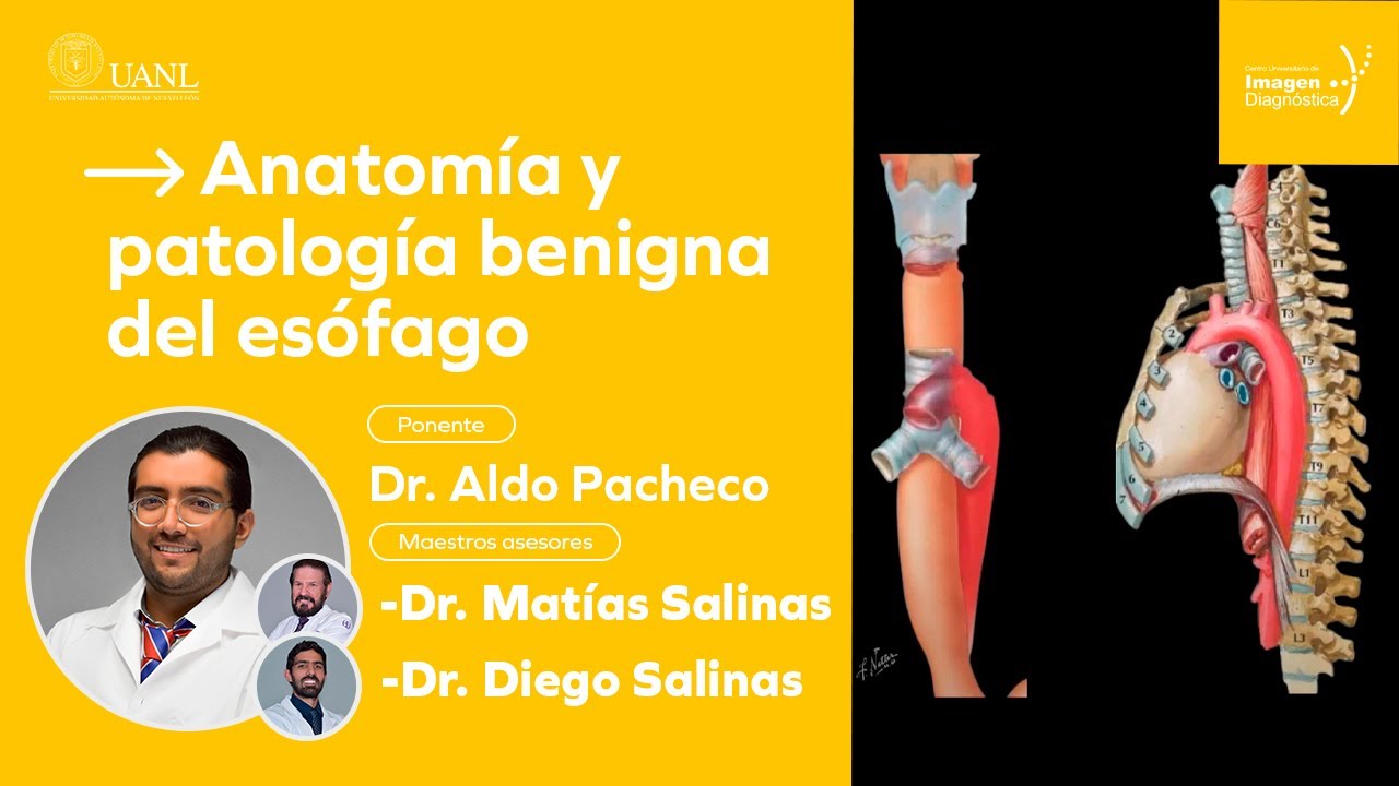 Anatomía y patología benigna del esófago por el Dr. Aldo Pacheco.