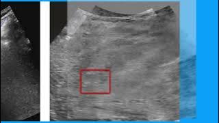 75BD15EE1BD8DD8A977C760C2A2C05#1