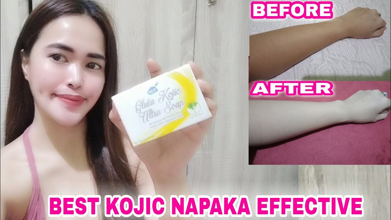 nakakaputi ba ang dove soap