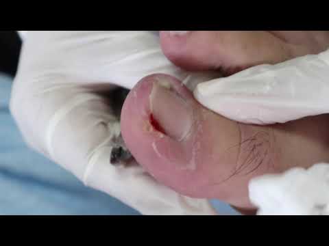 ผลสลากกินแบ่งรัฐบาล วันที่ 1 พย. 2567