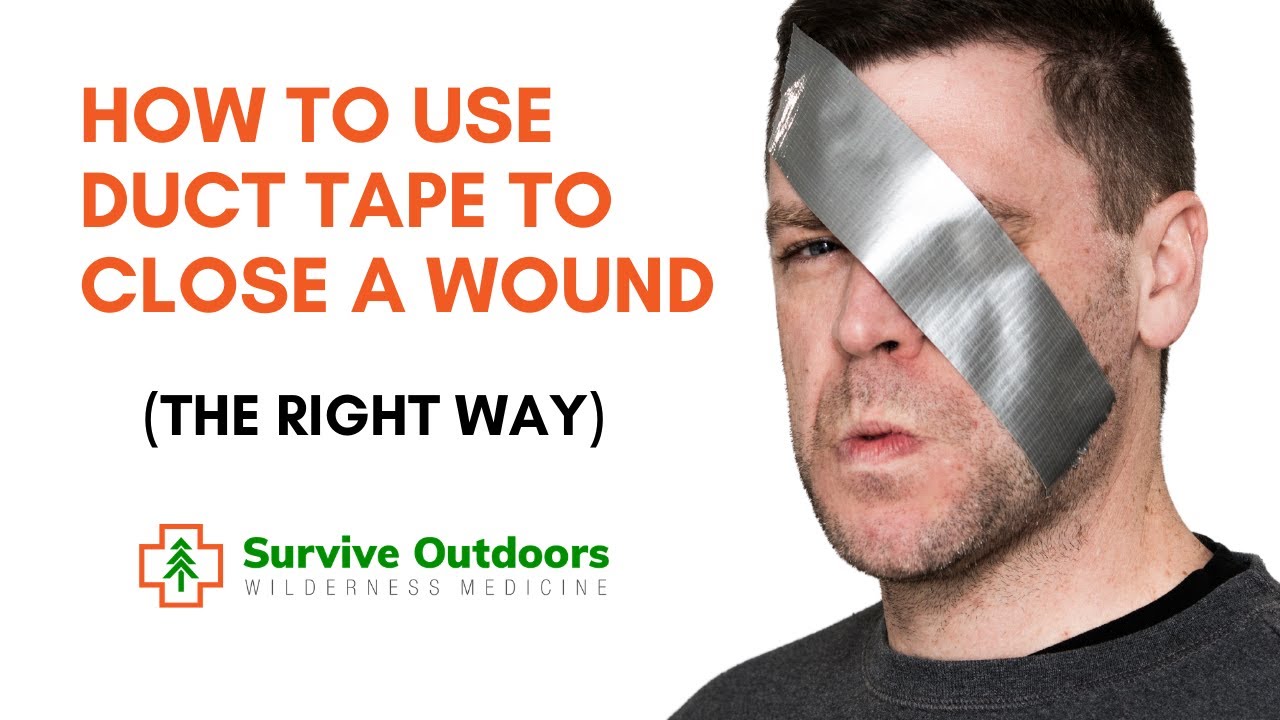 Wound Closure in the Outdoors using Duct Tape and Staples YouTube