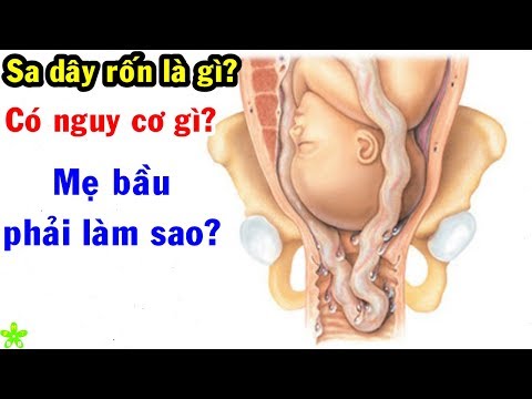 Sa Dây Rốn Là Gì - Sa dây rốn là gì? Sa dây rốn có nguy cơ gì? Mẹ bầu phải làm sao?