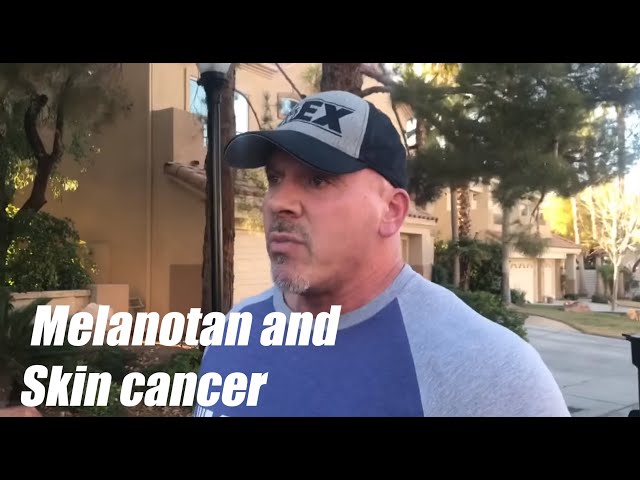 Melatonin and Skin Cancer | #RhinosRhants #TenTalks - YouTube